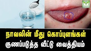 Home Remedies To Cure Blisters On Tongue  Tamil Health Tips [upl. by Carpet]