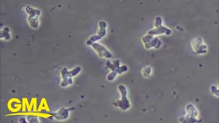 Disaster declaration after braineating amoeba found in water l GMA [upl. by Ailito]