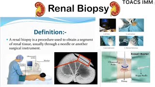 Renal Biopsy  Vim Silverman Renal Biopsy Needle  Indications  Contraindications  Procedure [upl. by Kecaj290]