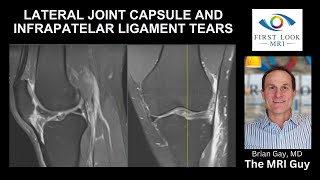 26 year old with knee injury from football [upl. by Ettennek]