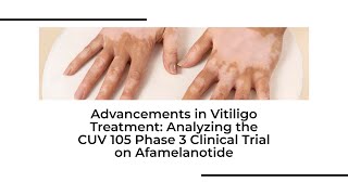 New HOPE for vitiligo  Phase 3 Clinical Trial of Afamelanotide amp Phototherapy  vitiligotreatment [upl. by Joachim]