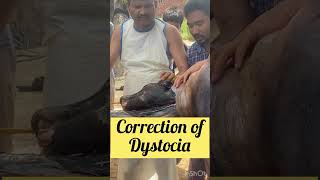 Correction of Dystocia l dr umar khan [upl. by Curtis]