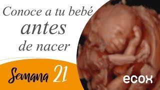 Vídeo de ecografía 5D de 21 semanas de gestación  Ecox [upl. by Nirrat]