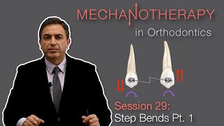 Mechanotherapy in Orthodontics Step Bends Pt 1 [upl. by Gilus958]