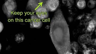 Labelfree Live Cell Imaging Tcells killing cancer cells  zoomedin [upl. by Calloway]