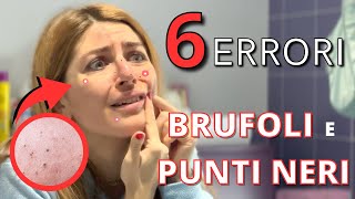 ELIMINARE BRUFOLI E PUNTI NERI 😱5 ERRORI CHE TUTTI FACCIAMO  E COME EVITARLI [upl. by Leshia]