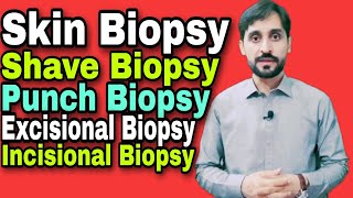 Skin Biopsy  Types of Skin Biopsy [upl. by Phelips]