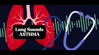 Understanding Asthma Lung Sounds Accurate Lung Assessment [upl. by Ahsieat71]