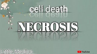 Necrosis and types of necrosis pathology robbins [upl. by Atinuj]