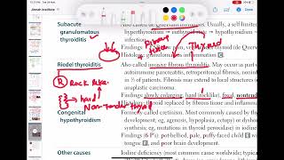 Riedel thyroiditis endocrinology 41  First Aid USMLE Step 1 in UrduHindi [upl. by Noxid]