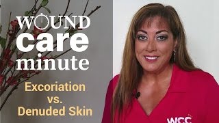 Whats the Difference Between Excoriation and Denuded Skin [upl. by Gualterio]