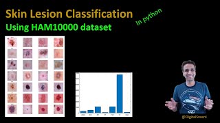 203  Skin cancer lesion classification using the HAM10000 dataset [upl. by Kirtley]