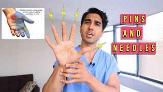 What Causes Pins and Needles in Hand at Night  Paresthesia [upl. by Llerod]