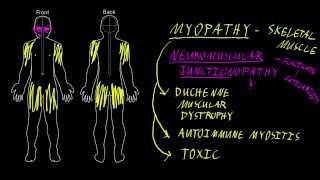 Myopathy and neuromuscular junctionopathy [upl. by Ianahs]