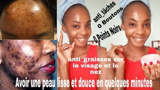 Presser les points noirs sur le nez points noirs suppression des points noirs vidéo de décompress [upl. by Melody]