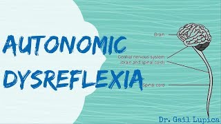 Autonomic Dysreflexia for Nursing Students [upl. by Nuahsyt423]