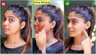 No Gelatin NEW PERMANENT FACIAL HAIR REMOVAL AT HOME  Rinkal Soni [upl. by Aneerhs]