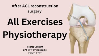 After ACL reconstruction surgery Physiotherapy all exercise after knee ligament surgery [upl. by Arabeila]