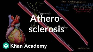 Atherosclerosis  Circulatory System and Disease  NCLEXRN  Khan Academy [upl. by Glassman]