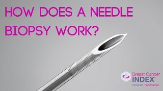 How Does a Needle Biopsy Work [upl. by Alilak396]