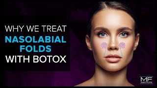 Using BOTOX® To Treat Nasolabial Folds at Mabrie Facial Institute [upl. by Anaoy434]