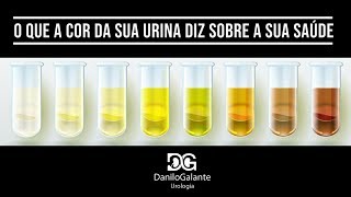 O QUE A COR DA SUA URINA DIZ SOBRE A SUA SAÚDE  INFECÇÃO URINÁRIA [upl. by Ymerej]