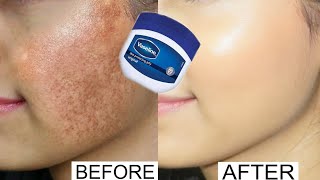 Vaseline for face pigmentation overnight  Vaseline on face at night benefits  Vaseline on face [upl. by Raamaj]