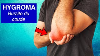 Bursite du coude Hygroma  Symptômes diagnostic et traitements [upl. by Niarfe778]