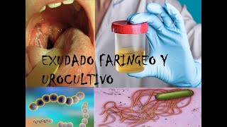 Exudado faríngeo y Urocultivo en Laboratorio [upl. by Anitsyrc424]