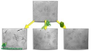 AntiAngiogenesis Cutting Off Tumor Supply Lines [upl. by Nirahs937]