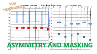 6C Asymmetrical Hearing When is Masking Required [upl. by Cash]