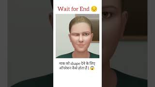 Nose operation 😱  shortsviral nose operation viral ytshort ytviral [upl. by Neel821]