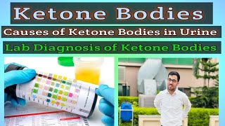 What is Ketones Bodies  What is Ketonuria Causes Symptoms amp Lab Diagnosis of Ketonuria [upl. by Astera]