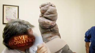 The Miracle Elephantiasis Treatment  HORROR STORY  River Monsters [upl. by Peers]