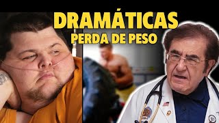 6 TRASFORMAÃ‡Ã•ES MAIS DRÃSTICAS EM QUILOS MORTAIS  ANTES E DEPOIS [upl. by Eunice130]