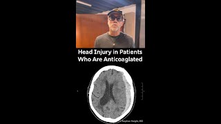 Head Injury in Patients Who Are Anticoagulated [upl. by Undry984]