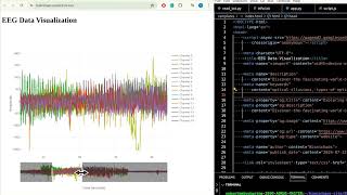 EEG Data Visualization with Flask amp Plotly RealTime Analysis Ethics and Seizure Detection [upl. by Annoved]