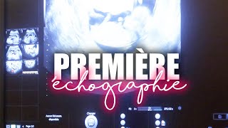 LA PREMIÈRE ÉCHOGRAPHIE PREMIER TRIMESTRE  VLOG GROSSESSE [upl. by Jentoft]