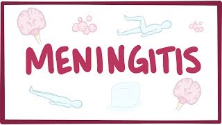 Meningitis  causes symptoms diagnosis treatment pathology [upl. by Yelrahs]