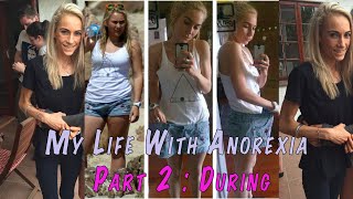 REAL AND RAW  My Life With Anorexia  My Story Of During Anorexia  Eating Disorder Series [upl. by Early]