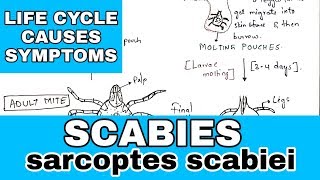 Scabies  sarcoptes scabiei  Life cycle causes symptoms  Bio science [upl. by Tniassuot]