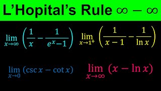 LHopitals Rule  Indeterminate form Infinity minus Infinity  ∞ – ∞  Calculus [upl. by Nadabus]