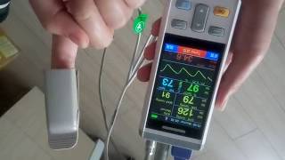 Wuhan UNmedical handheld vital signs monitorBy Shirley Huflv [upl. by Dow]