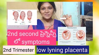 Low lyning placenta  placenta previa 2nd trimester in pregnancy viralvideo trending vlogs [upl. by Naylor]