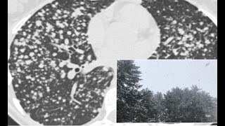 chestRadiologysigns🛑2Chest imaging using signs symbols and naturalistic images [upl. by Charity]