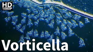 Vorticella Under Microscope [upl. by Naujyt]