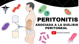 DIÁLISIS PERITONEAL Infección Diagnostico tratamiento y Prevención [upl. by Tager]