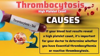 THROMBOCYTOSIS OR High Platelet Count  Cause  Symptoms  Complications  Treatment [upl. by Ajna]