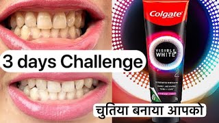 Colgate Visible White 02 Toothpaste Review Get Whiter Teeth in 3 Days Exposed [upl. by Anitserp670]