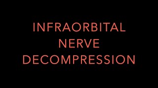 INFRAORBITAL NERVE DECOMPRESSION [upl. by Ethelbert]